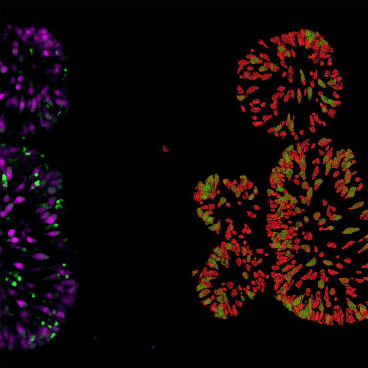 Darmorganoide, dTomato-gefärbte Zellen in Rot, Nachweis doppelt-positiver (mNeon-gefärbter) Zellen in Grün.