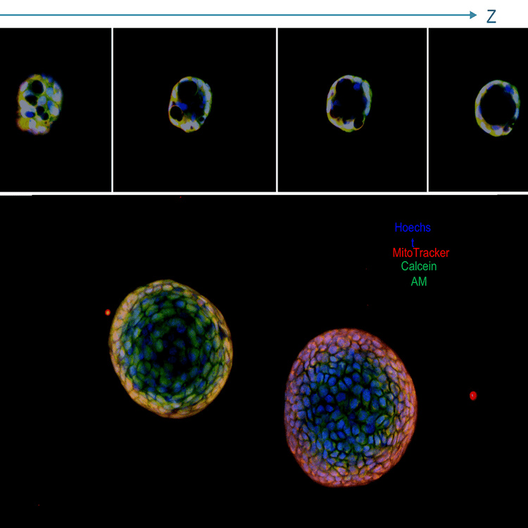 Lung organoids,projection image and a panel with Z stack