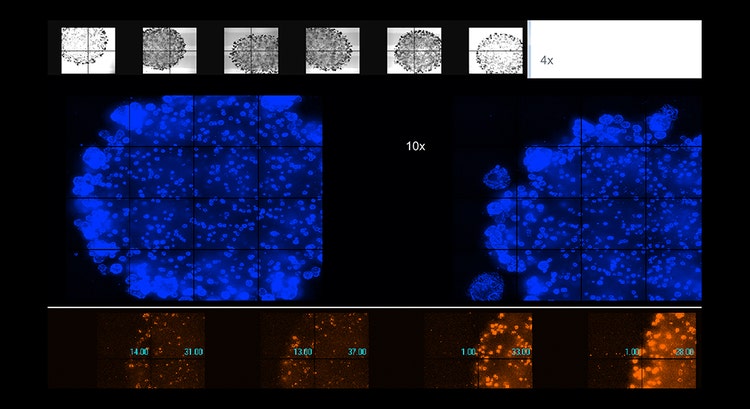 Automated imaging of live organoids in Matrigel, 4x or 10x magnification