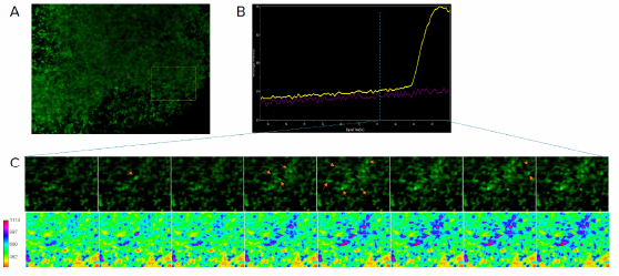 Calcium-Imaging von Gehirnorganoiden zur Bestimmung der neuronalen Aktivität