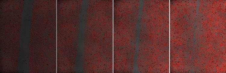 Zellmigrations-Assays
