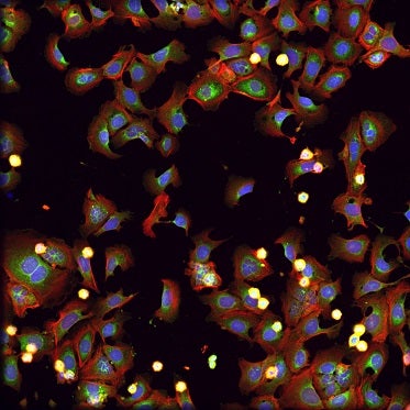 Mit Rotenon, ein in Insektiziden häufig verwendetes Toxin, behandelte Zellen