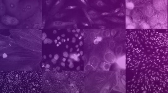 Rekursion produziert den größten öffentlich zugänglichen Datenset zur Morphologie menschlicher Zellen für die COVID-19-Therapeutika-Forschung