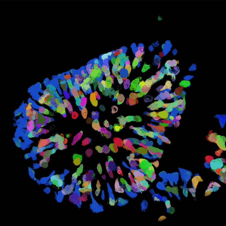 Neurone in einer 1536-Well-Platte bei 60x-Vergrößerung, aufgenommen mit dem ImageXpress Micro Confocal System