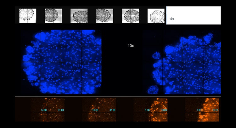 Automatisiertes Imaging lebender Organoide in Matrigel, 4x oder 10x Vergrößerung