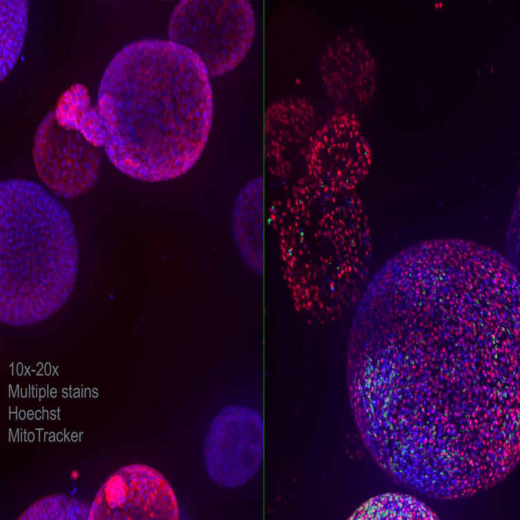 Nukleine gefärbt mit Phalloidin, aufgenommen bei 60x-Vergrößerung mit dem ImageXpress Nano System