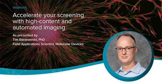 High-Content und automatisiertes Imaging – Webinar