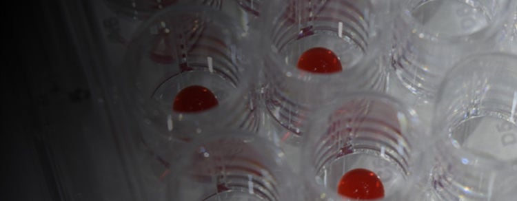 3D-Bioprinting