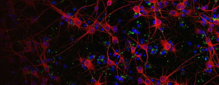 Neuritenauswuchs