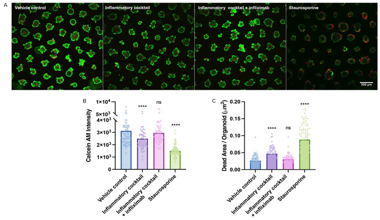 Response of human rectal organoids exposed to pro-inflammatory cytokines