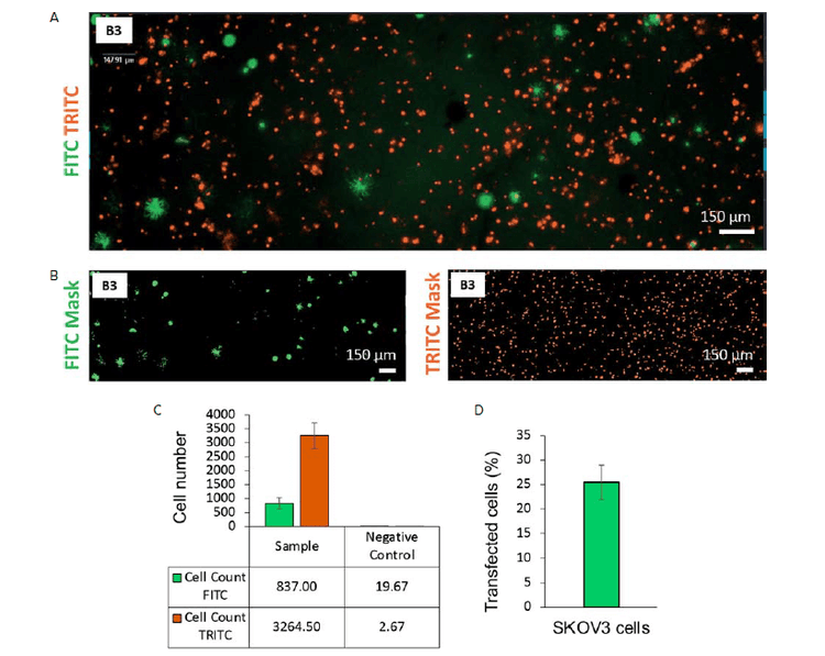 Analysis of a 3D bioprinted structure containing SKOV3 cells transfected with a GFP plasmid and MeWO cells