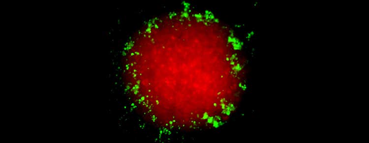 T-cell invasions assay