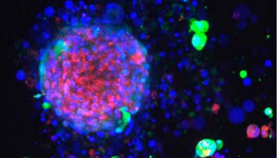 Cell Painting in a 3D breast cancer spheroid model