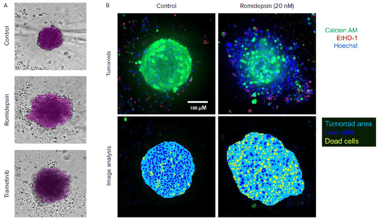 Automated image analysis of 3D cancer microtissues