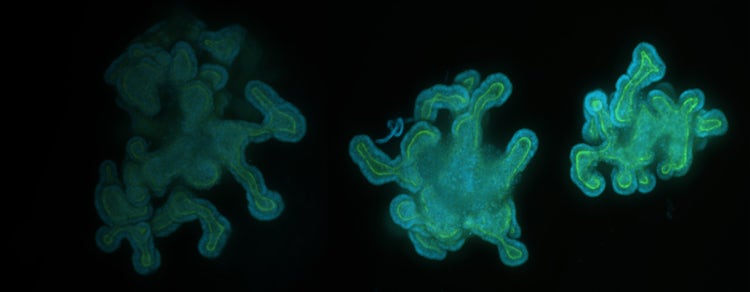 intestinal organoids