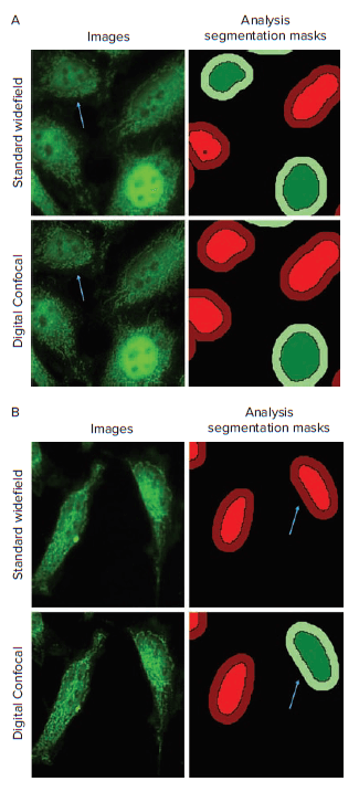 Translocation Analysis of Standard Widefield and Digital Confocal Images