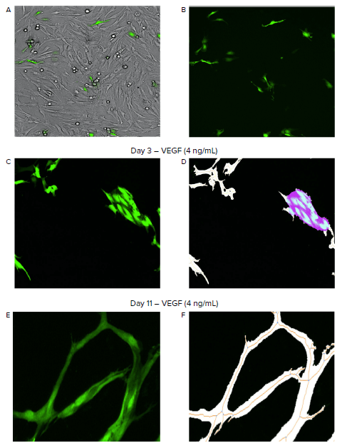 Automated imaging and analysis of angiogenesis with the ImageXpress Pico system