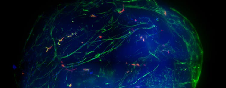 3D human brain micro-tissues