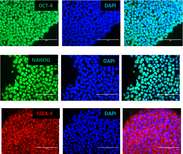 Pluripotente iPS-Zellen exprimieren Pluripotenzmarker – Oct-4, Nanog und SSEA4