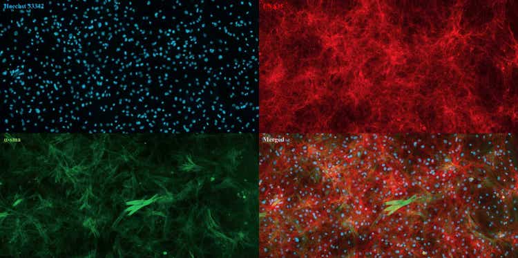 Bilder, die mit dem ImageXpress Pico Automated Cell Imaging System von aus Kuhhaut isolierten und kultivierten dermalen Fibroblasten aufgenommen wurden. Zellkerne (blau), Kollagen (rot), glattmuskuläres Alpha-Aktin (grün)