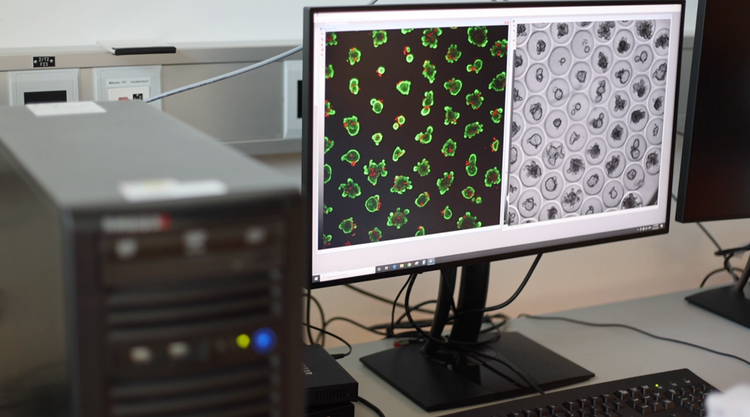 high-throughput organoid