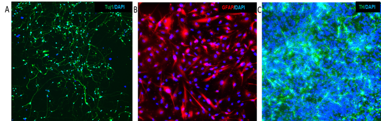 Aus iPSCs gewonnen – Tuj1, GFAP und TH mit DAPI-Gegenfärbung der Zellkerne