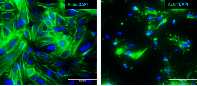 Zerstörung des Zytoskeletts – aus iPSC gewonnene Hepatozyten mit Aktinfärbung, gezeigt für unbehandelte und mit Latrunculin behandelte Zellen