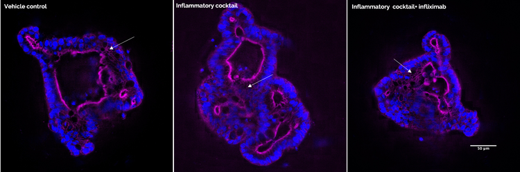 Images of human rectal organoids exposed to pro-inflammatory cytokines