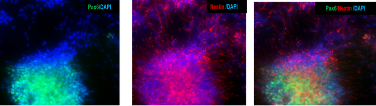Aus iPSCs gewonnene neuronale Vorläuferzellen exprimieren die neuronalen Vorläuferzellmarker PAX6 und Nestin