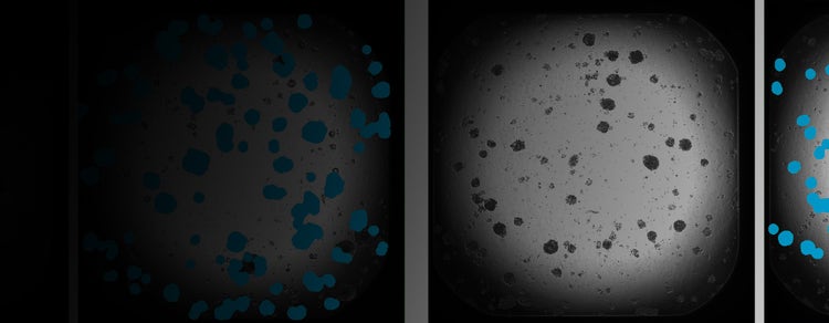 patient-derived colorectal cancer organoids