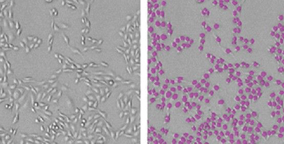 Labelfreie Lebendzellen-Assays