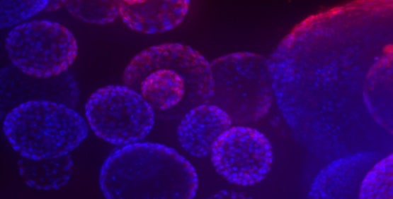 Organoide (3D) multizelluläre Mikrogewebe