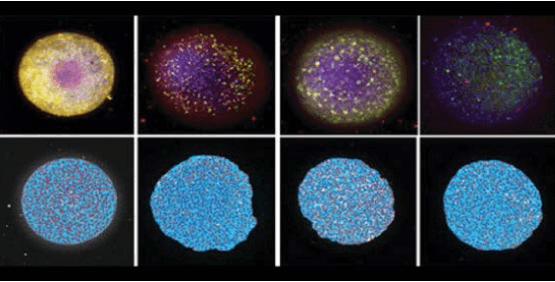 Neuronale 3D-Sphäroide, die aus menschlichen iPSC-Zellen gebildet werden