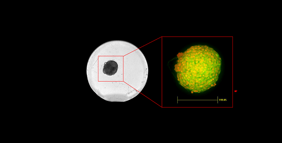 Die QuickID Targeted Acquisition arbeitet so, dass sie das gesamte Sichtfeld (Field of View, FOV) erfasst