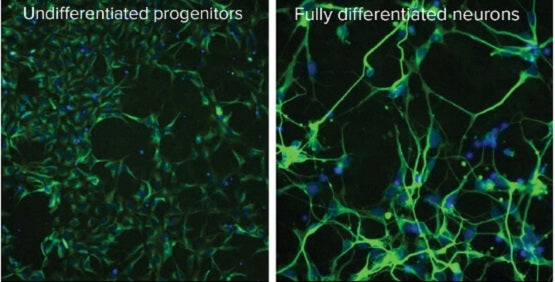 Expansion und Differenzierung neuronaler Stammzellen