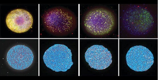 Neurotoxizität, neuronale Toxizität