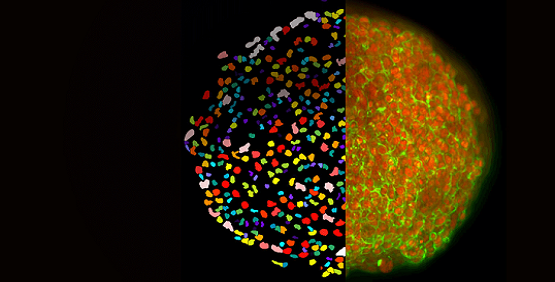 Verbessern Sie die Empfindlichkeit, Geschwindigkeit und Qualität für komplexe biologische Assays