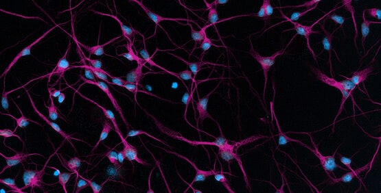 Induzierte pluripotente Stammzellen (iPSCs)