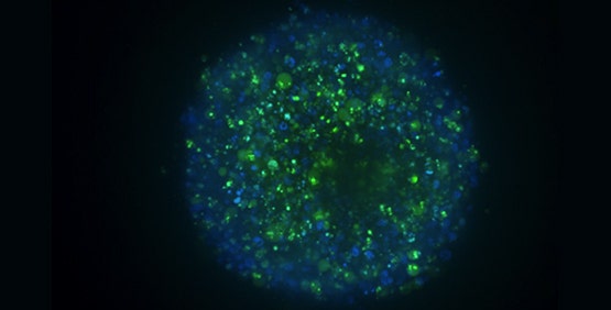 3D-Krebssphäroide imitieren den Tumor