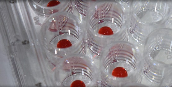 3D-Bioprinting