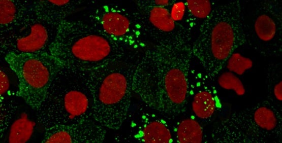 Zelluläre Imaging-Systeme für High-Content Imaging (HCI) und High-Content-Analyse (HCA)