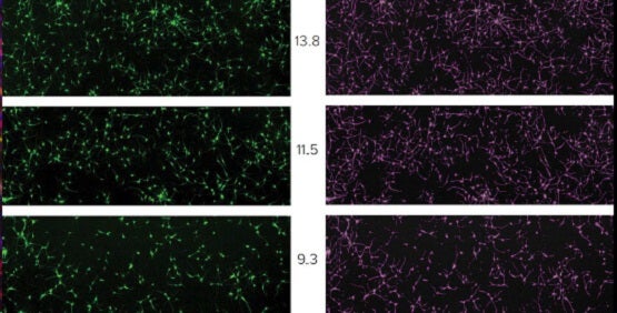 Die Imaging-Zytometrie macht komplexe zellbasierte Assays möglich