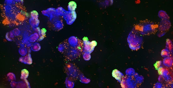 Darm-Organoide sind 3D-Gewebemodelle