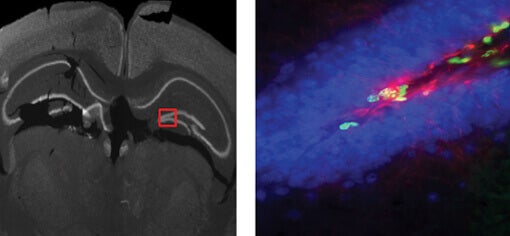 Hippocampus auf einem Objektträger mit Hirnschnitten