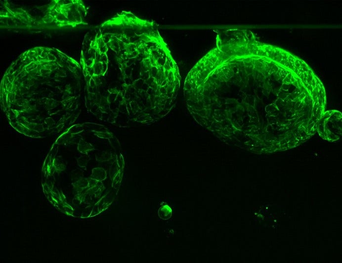 Organoid vs. Sphäroid