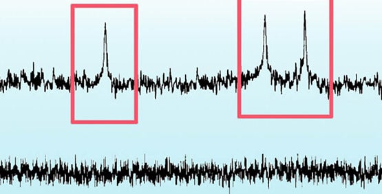 Ereigniserkennungsmodul, das spontane und evozierte Aktionspotenziale und postsynaptische Daten analysiert