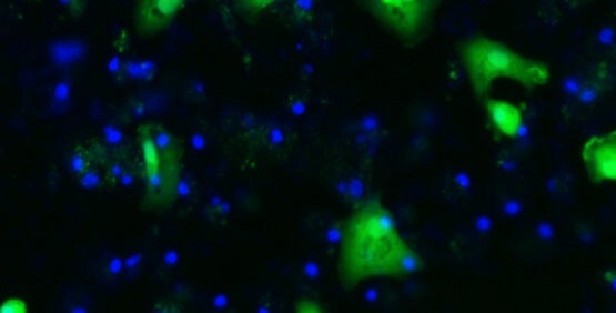 Stammzellen in Hepatozyten differenziert