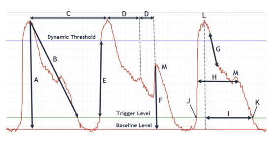 In-vitro-Bewertung der durch eine Verbindung hervorgerufenen pro-arrhythmischen Wirkungen