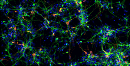 Neuronen-, Neuritenauswuchs