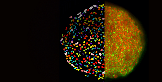 Laserbeleuchtung hochkomplexer zellbasierter 2D- und 3D-Assays